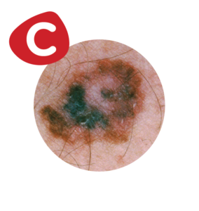 MoleMapping_C