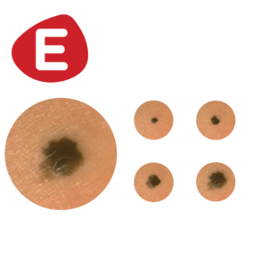 MoleMapping_E