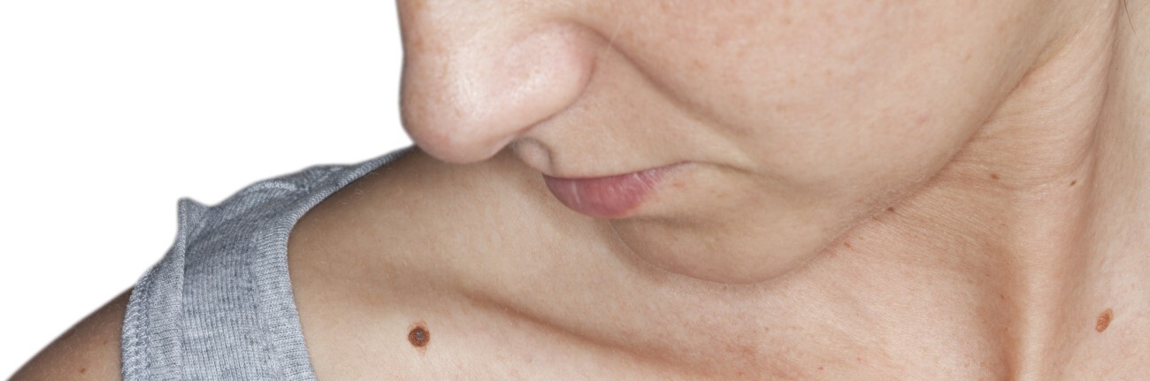Mole_1300